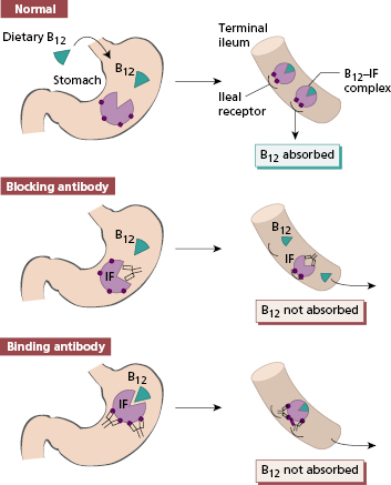 c14-fig-0010