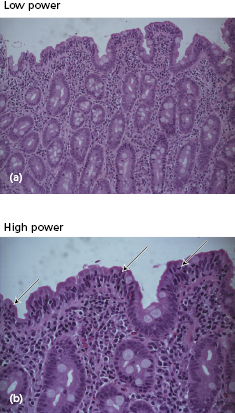 c14-fig-0012