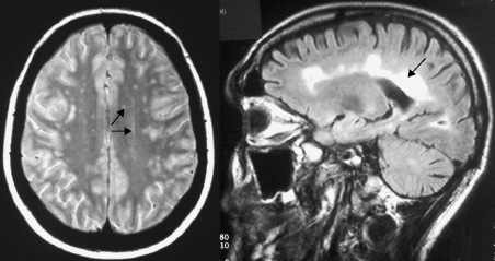 c17-fig-0001