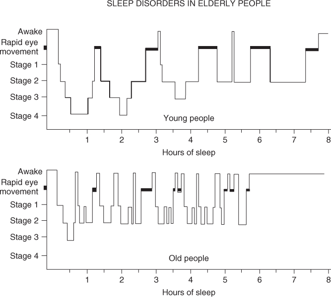 sleep stages hypnogram