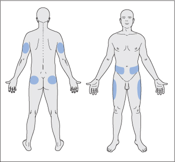 ch35-fig35.2.jpg