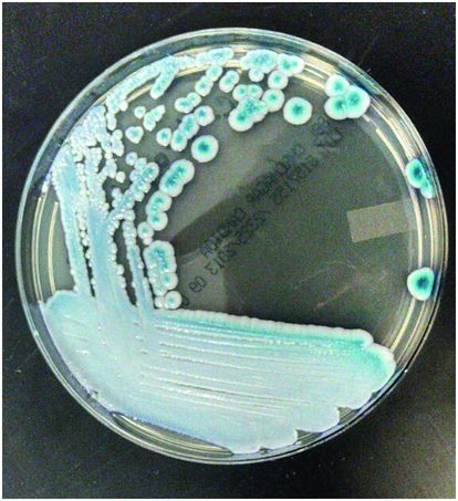 Candidiasis Oncohema Key