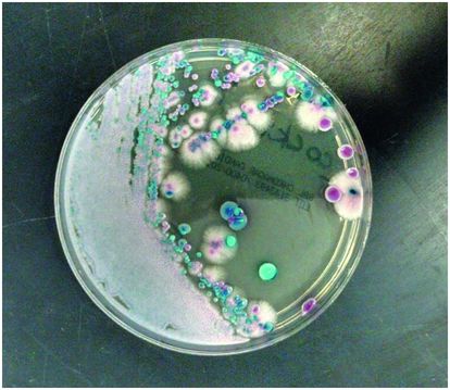 Candidiasis Oncohema Key