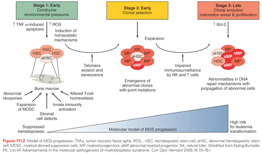 myelodysplastic syndrome diagram