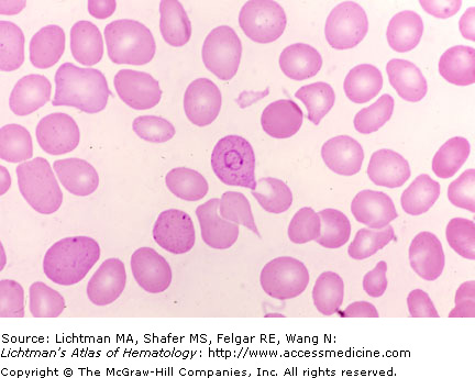 PPT - Practical of Clinical Hematology PowerPoint Presentation, free  download - ID:2238955