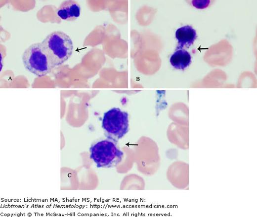 Mitotic Figures | Oncohema Key