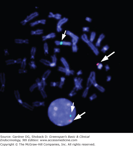 Disorders Of Sex Determination And Differentiation Oncohema Key