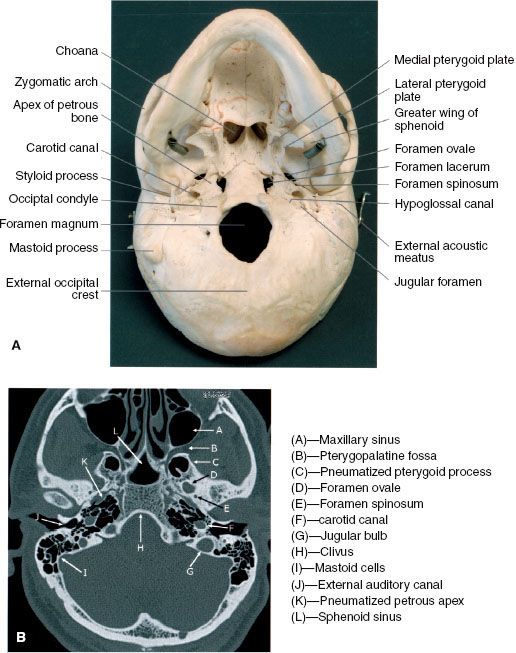 pharyngeal canal skull