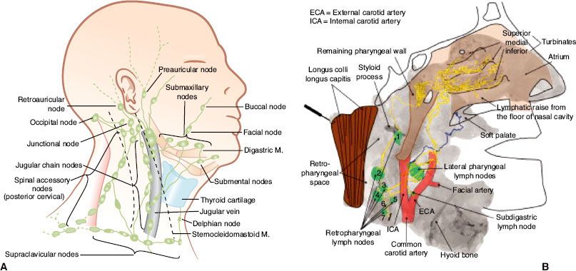 nasopharynx oncohema key