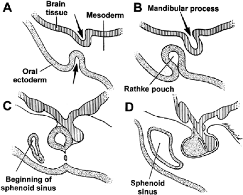 What Is Rathke S Pouch Development Of The Pituitary Tongue And 