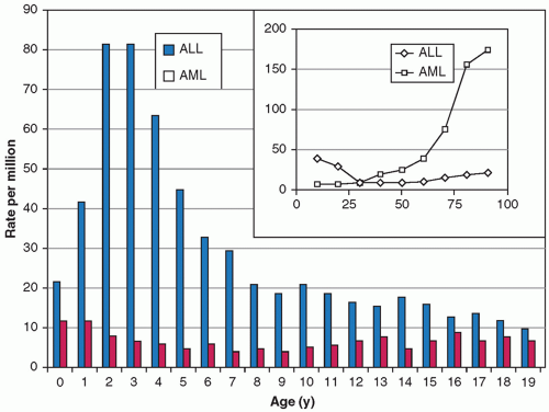 Acute Lymphoblastic Leukemia Oncohema Key