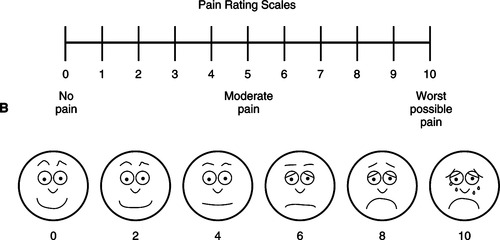 32. PAIN | Oncohema Key