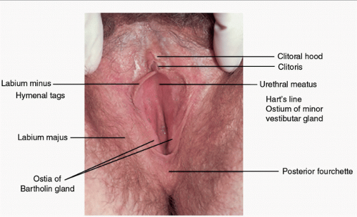 Pathology Of Cancers Of The Female Genital Tract