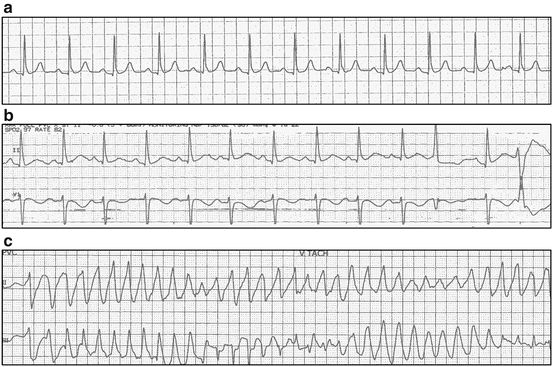 Cardiac Emergencies in Cancer Patients | Oncohema Key