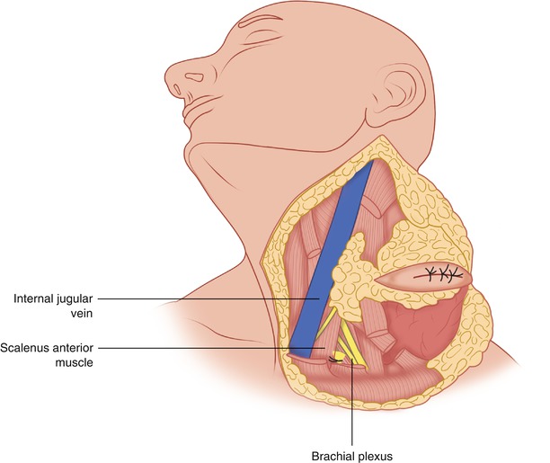 A304668_1_En_14_Fig3_HTML.jpg