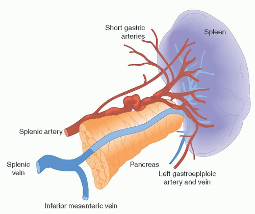 Disorders of the Spleen | Oncohema Key