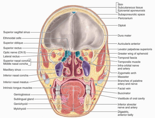 Paranasal Sinuses By Asklepios Medical Atlas Ph 7511