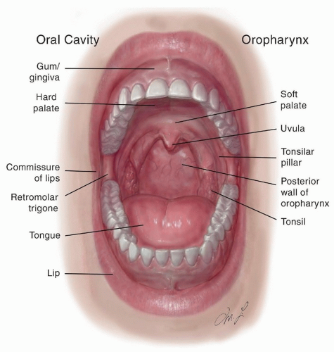 trigone leukoplakia