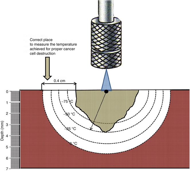 A216773_1_En_23_Fig2_HTML.jpg