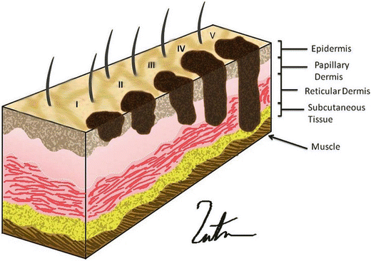 A310615_1_En_1_Fig3_HTML.gif