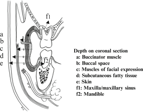 A315028_1_En_2_Fig15_HTML.gif