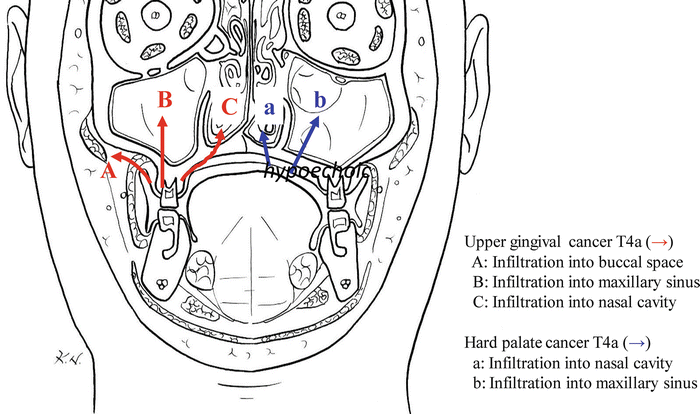 A315028_1_En_2_Fig9_HTML.gif