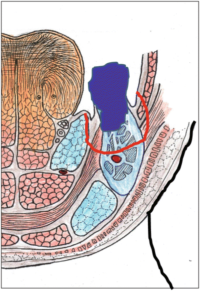 A315028_1_En_7_Fig34_HTML.gif