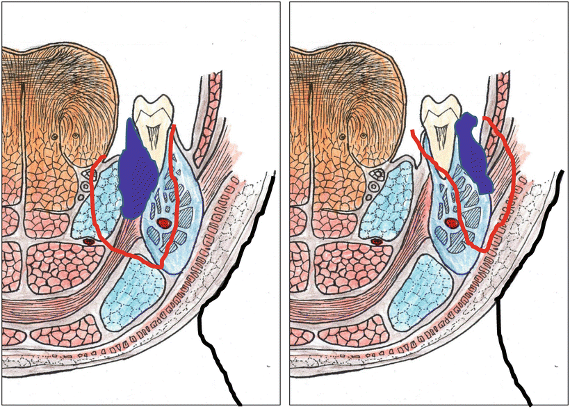 A315028_1_En_7_Fig35_HTML.gif