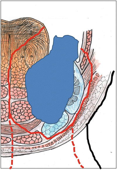 A315028_1_En_7_Fig37_HTML.gif