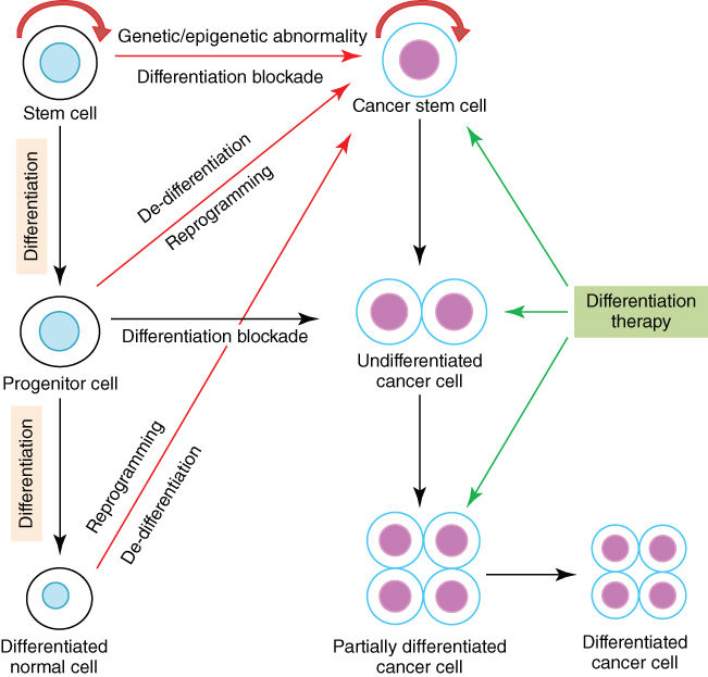 Differentiation therapy | Oncohema Key