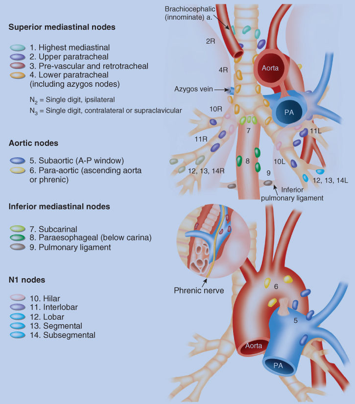 Diagram Of Lymph Node Stations Choice Image - How To Guide 