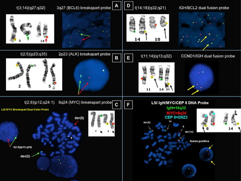 Cytogenetics | Oncohema Key