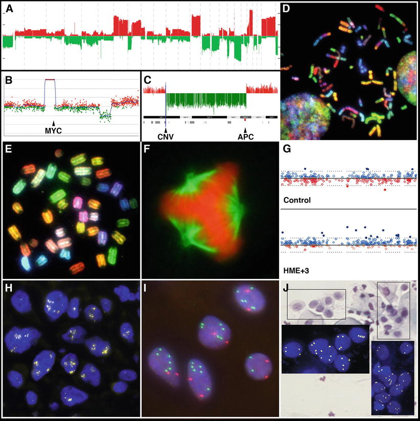 Cancer Cytogenetics | Oncohema Key