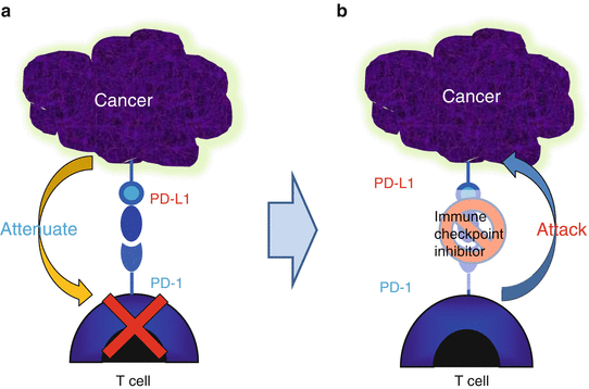 Immunology And Immunotherapy In Ovarian Cancer | Oncohema Key