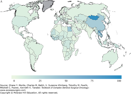 Hepatocellular Carcinoma | Oncohema Key