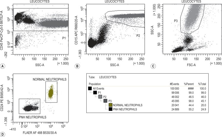 Acquired Haemolytic Anaemias | Oncohema Key