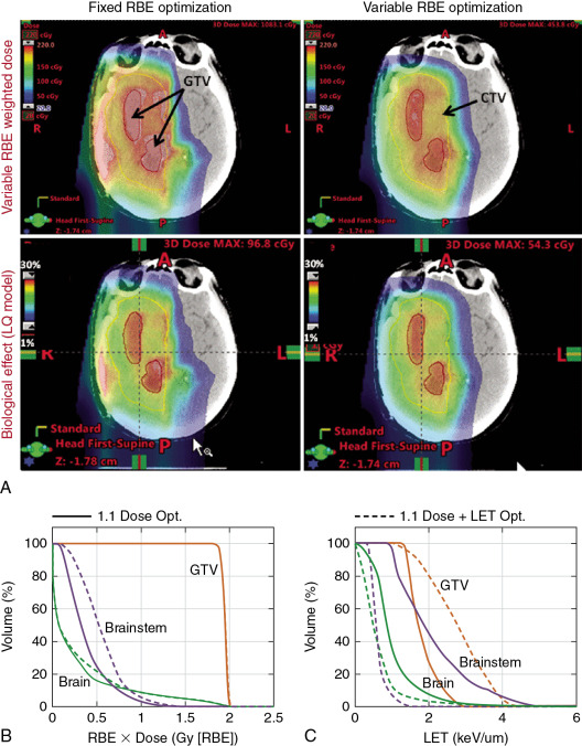 Principles Of Proton Beam Therapy | Oncohema Key