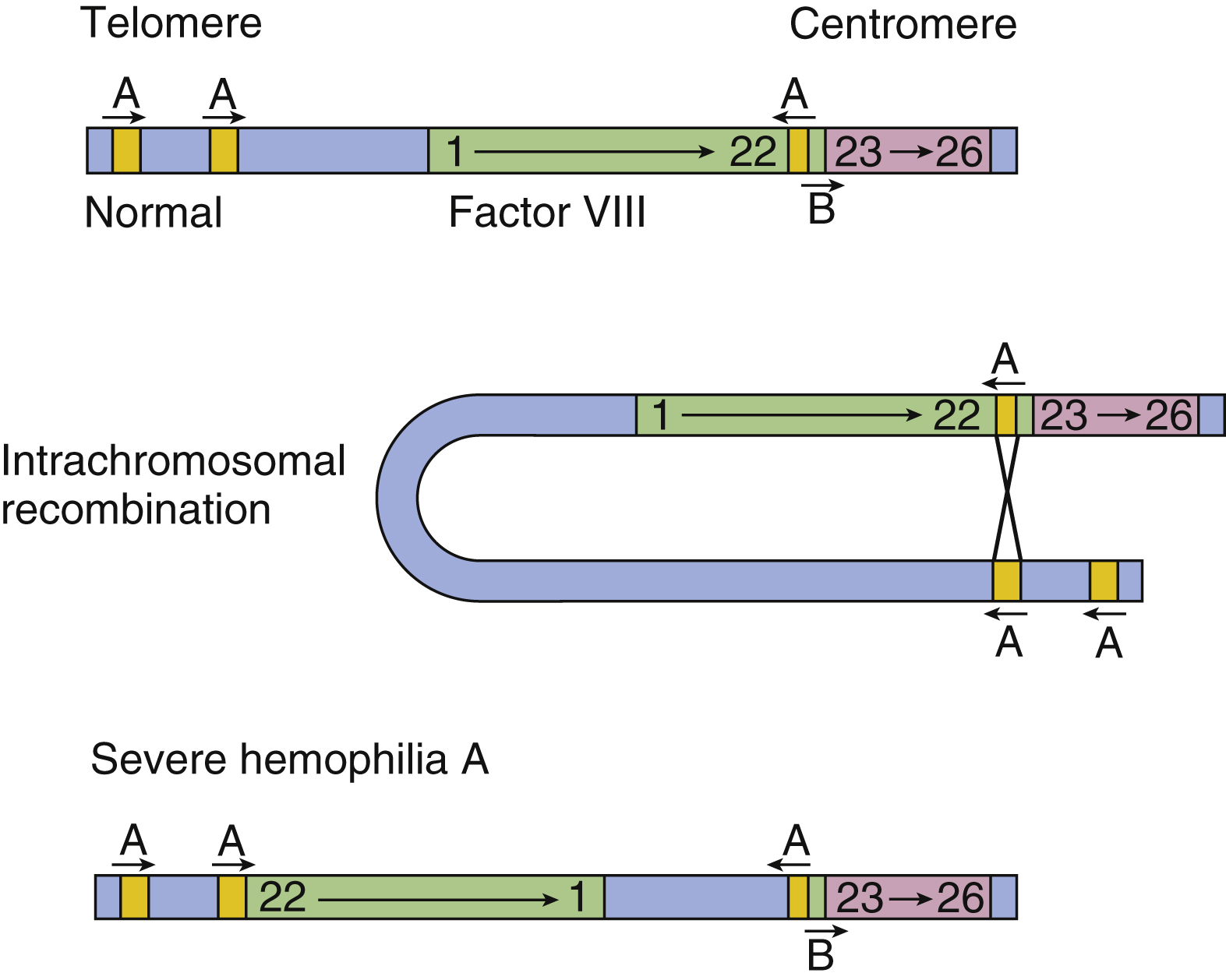 Hemophilia | Oncohema Key